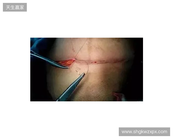 广州豹官方：杨浩眉弓伤口缝合30余针，预计5-7天后拆线